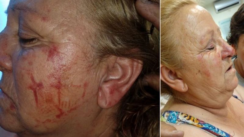 Brutal robo a una mujer: le marcaron la zapatilla en la cara a patadas