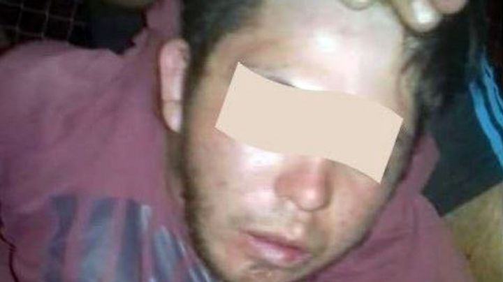 Terrible linchamiento en Neuquén: le cortaron los dedos a un delincuente