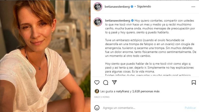 "Dejarlo ir": Betiana Wolenberg habló de la dura pérdida que sufrió con el sanjuanino Nicolás Magaldi
