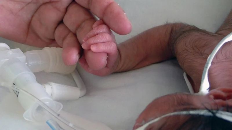 Foto: Se registró el nacimiento de una bebé con cola de casi 6 centímetros